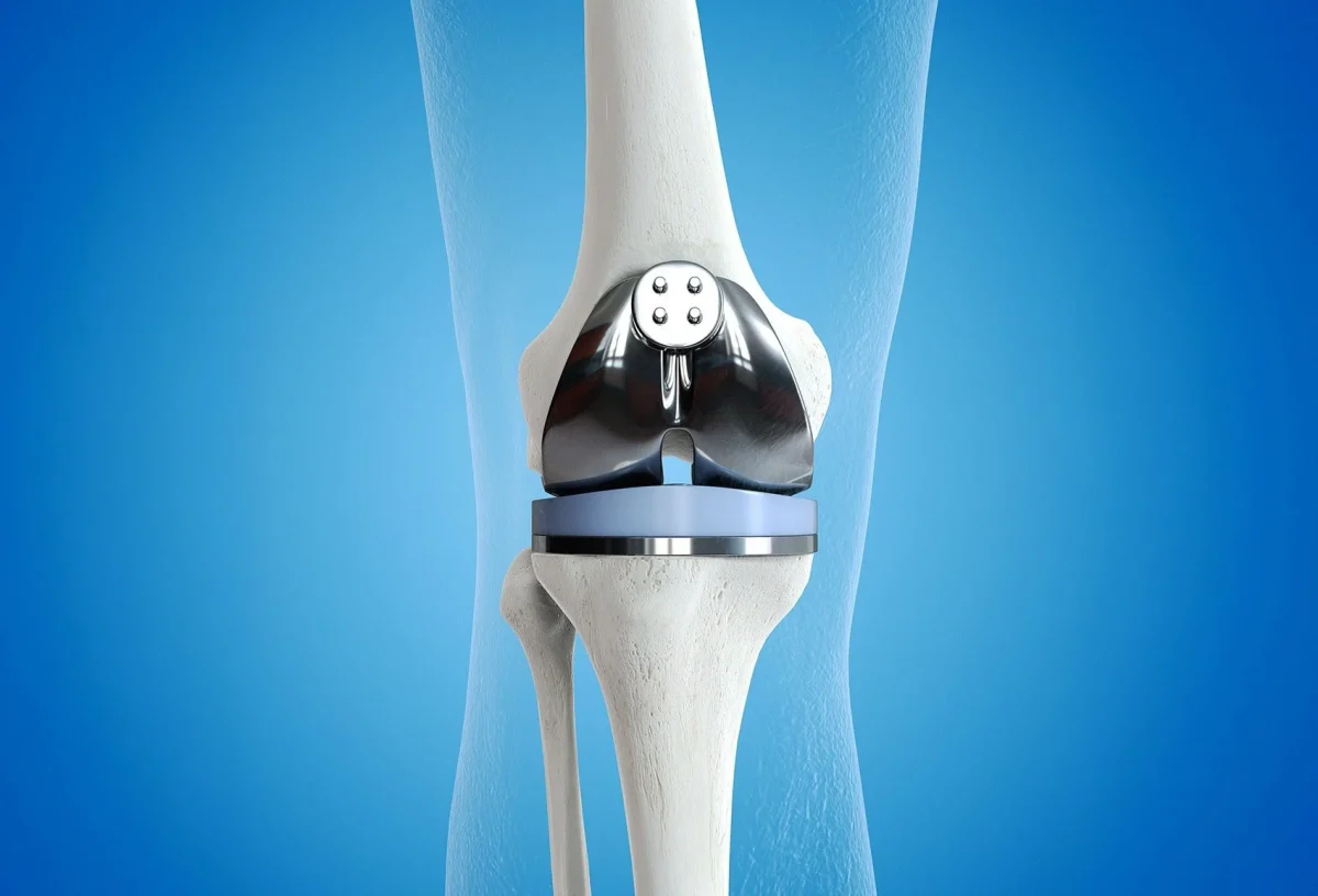 Top Benefits of Consulting an Experienced Total Knee Replacement Surgeon in Jaipur Top Benefits of Consulting an Experienced Total Knee Replacement Surgeon in Jaipur