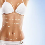 full-body-liposuction-services.jpg