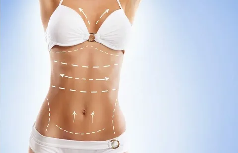 How Full Body Liposuction Services Help Stubborn Belly Fat Disappear