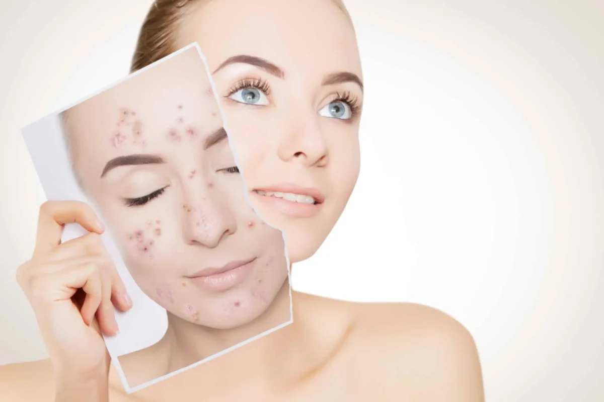 Why the Best Skin Clinic in Kolkata Is the Right Choice for Your Skin Problems Why the Best Skin Clinic in Kolkata Is the Right Choice for Your Skin Problems