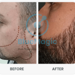 beard-before-after-2.png