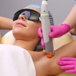 laser-hair-removal.jpg
