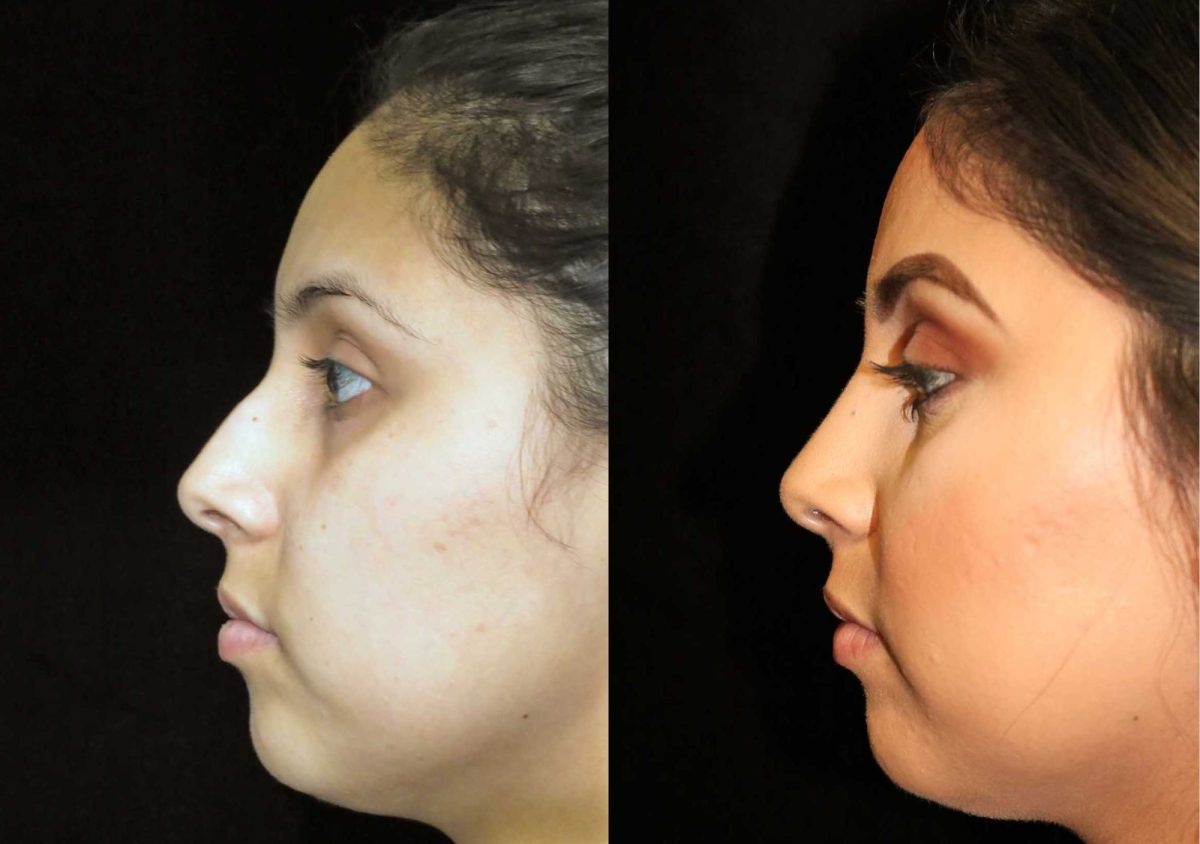 لماذا تعتبر دبي الوجهة الأكثر أماناً لعمليات تجميل الوجه؟