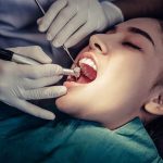 Root-canal-treatment.jpg