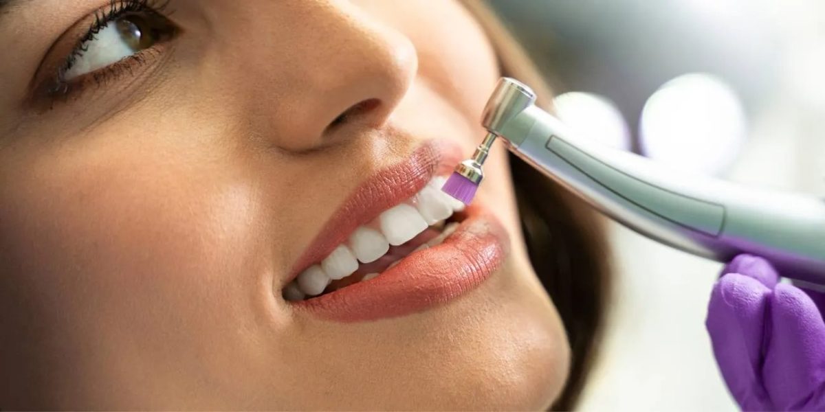 Can Teeth Polishing Be Done Without a Dentist?