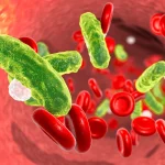 Bloodstream-Infections.webp