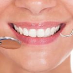 tooth-fillings-soothing-care-dental-rozelle.jpg