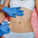 Bariatric-Surgery-in-Islamabad-1.jpg