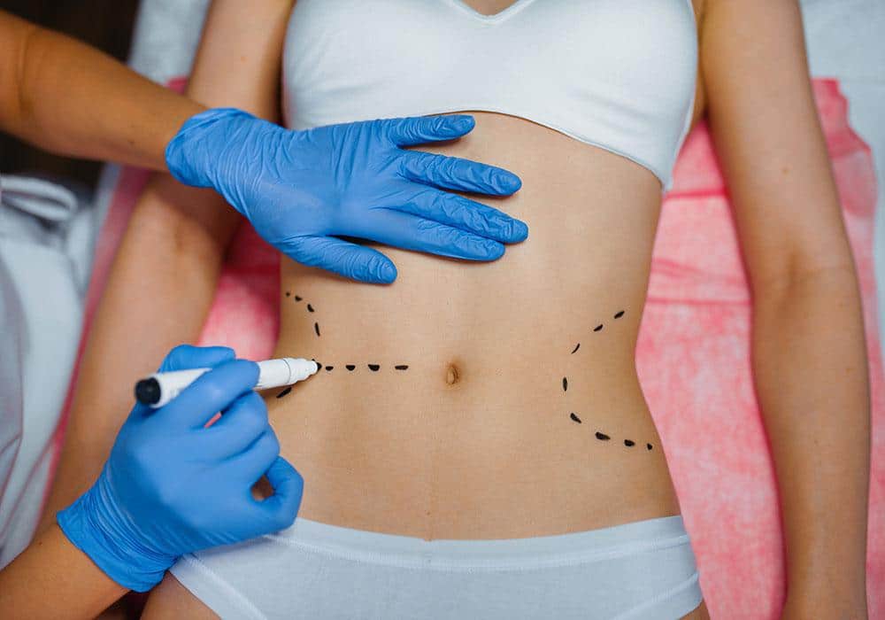 Low-Cost Bariatric Surgery in Islamabad: A Complete Guide