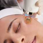 Best-microneedling-in-Islamabad.jpg