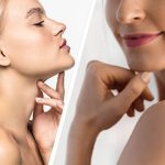 Double-Chin-Liposuction-in-Islamabad-1.jpg