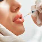Lip-Filler-in-Islamabad-1.jpg