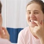 top-9-methods-to-fix-receding-gums-naturally.jpg