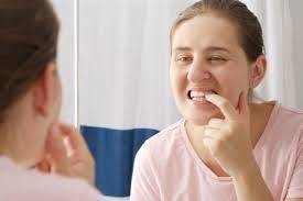 Top Natural Methods to Fix Receding Gums and Strengthen Teeth