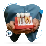 Dental-Implants-1024x1024.png