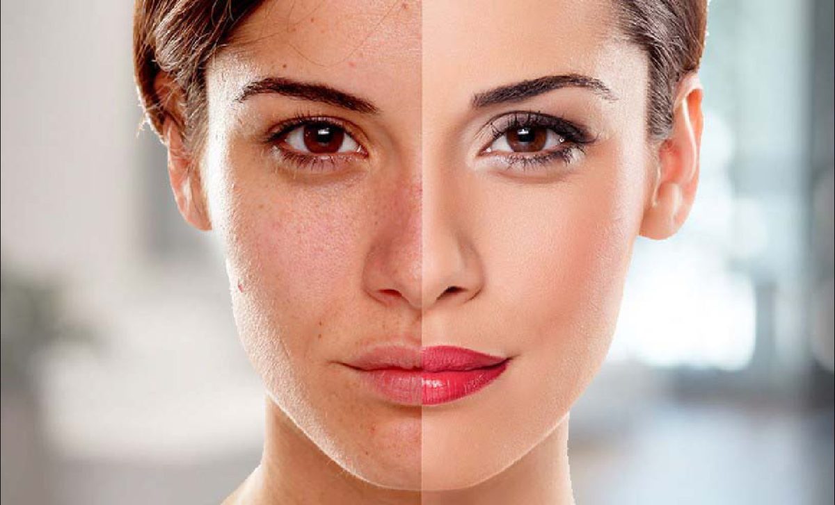Skin Whitening for Dark Spots in Islamabad