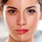 Skin-Whitening-in-Islamabad.jpg