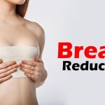 breast-reduction-scars.jpg