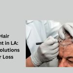 Best-Hair-Transplant-in-LA-Modern-Solutions-for-Hair-Loss.jpg