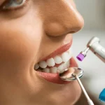 professional-teeth-whitening-in-Perth.webp