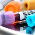 Cortisol-Blood-Test-A-Complete-Patient-Guide.jpg