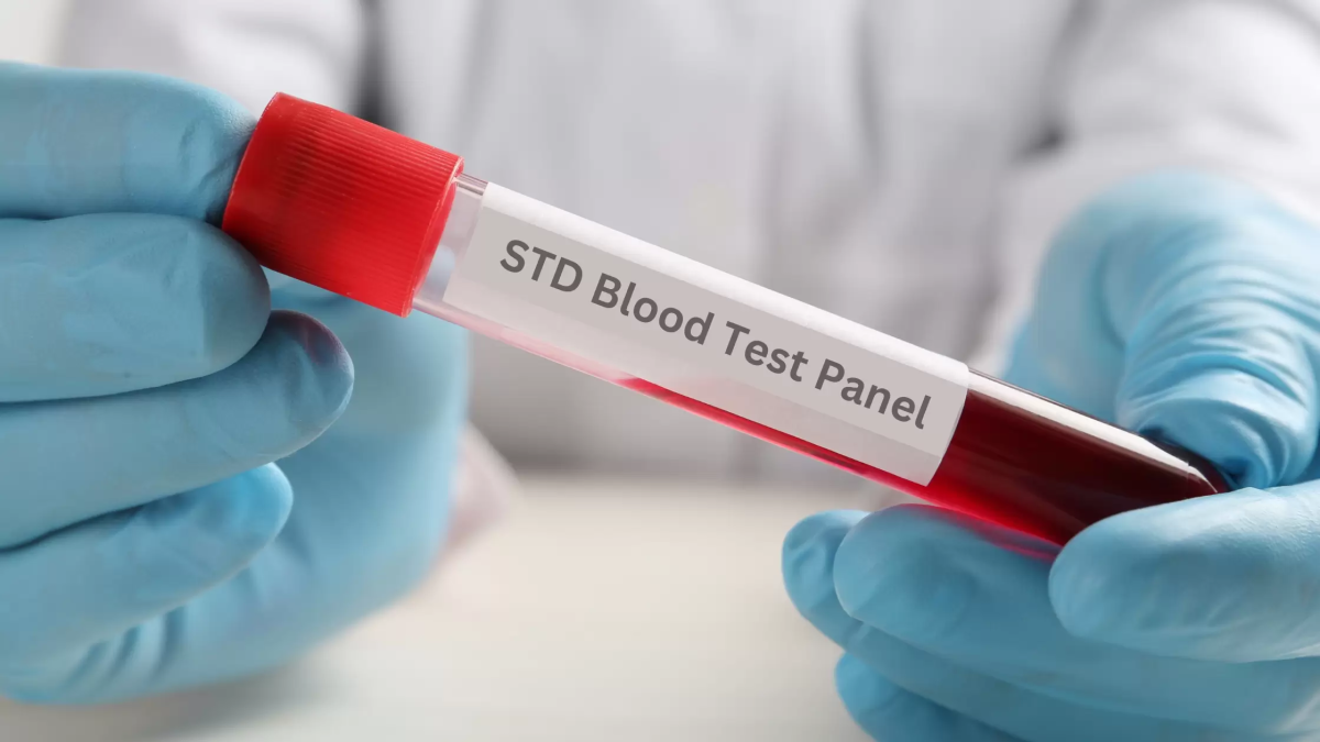Full Blood Test Explained: Understanding Your Results