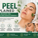 VI-peel-facial.png