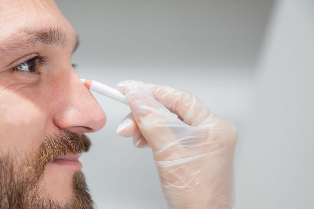 Why Rhinoplasty in Islamabad Is Popular Among Detail-Oriented Individuals