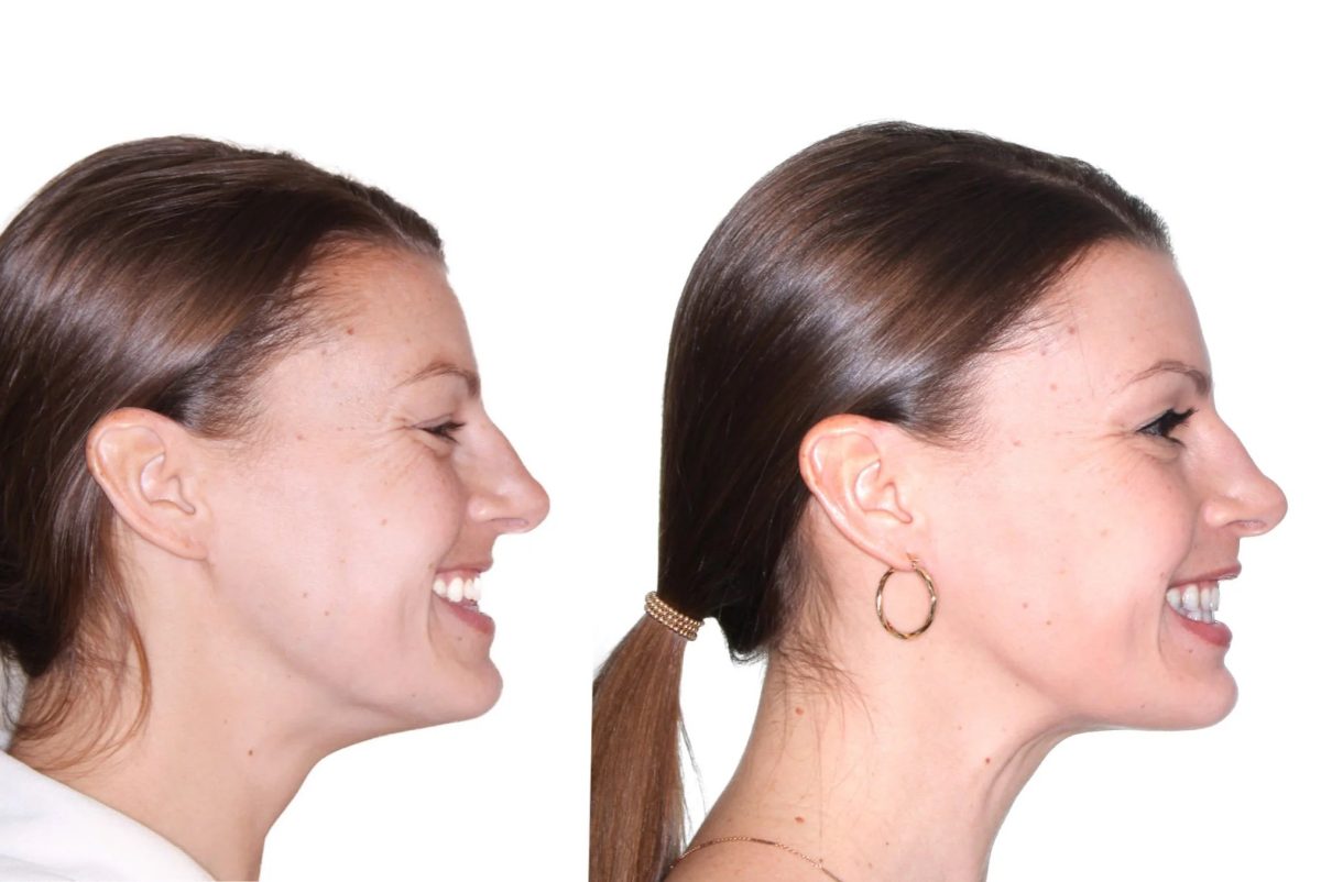 Jaw Surgery in Islamabad for Creating a Stronger and More Defined Facial Structure Jaw Surgery in Islamabad for Creating a Stronger and More Defined Facial Structure