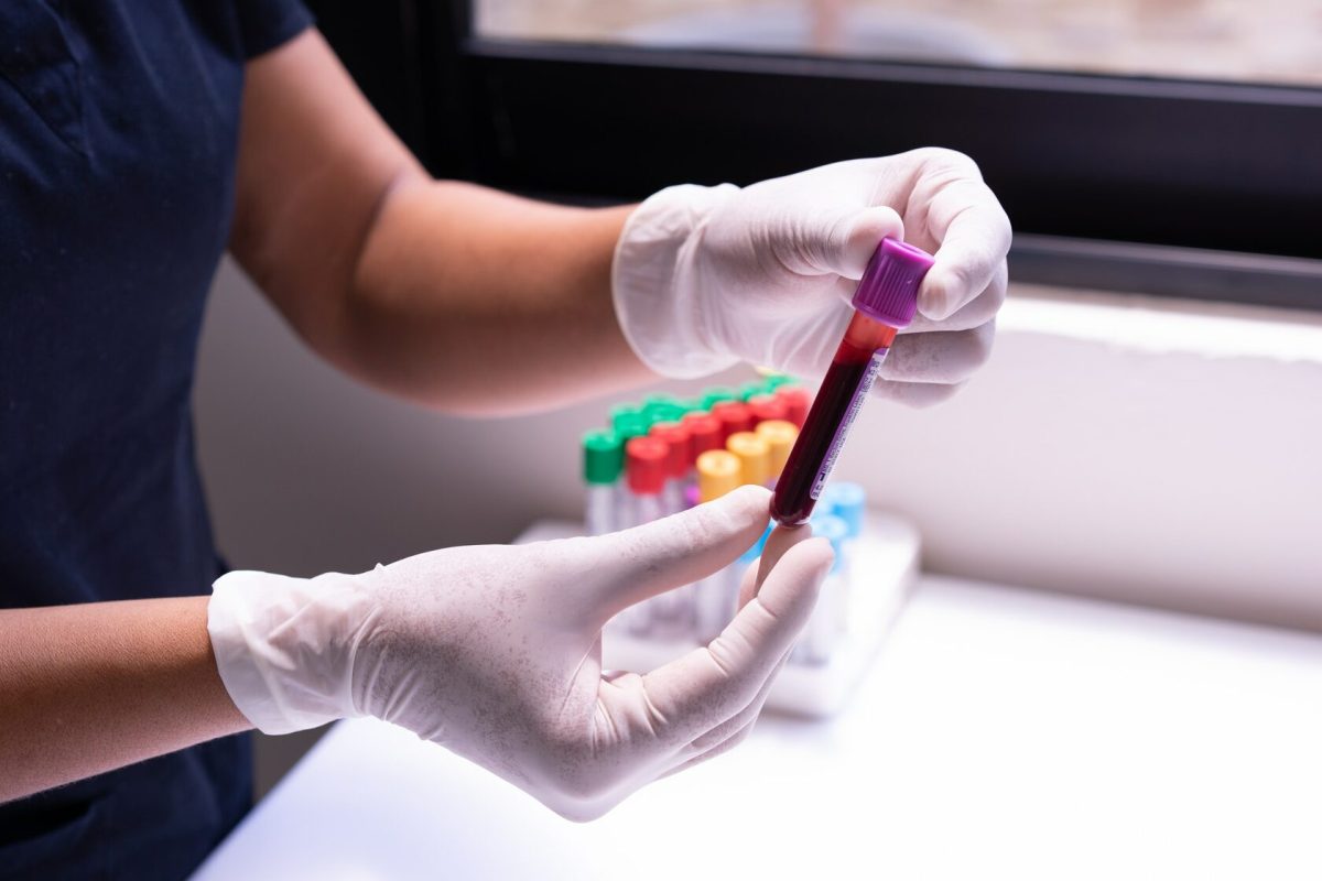 Marriage Blood Test Explained: Benefits, Process, and Results