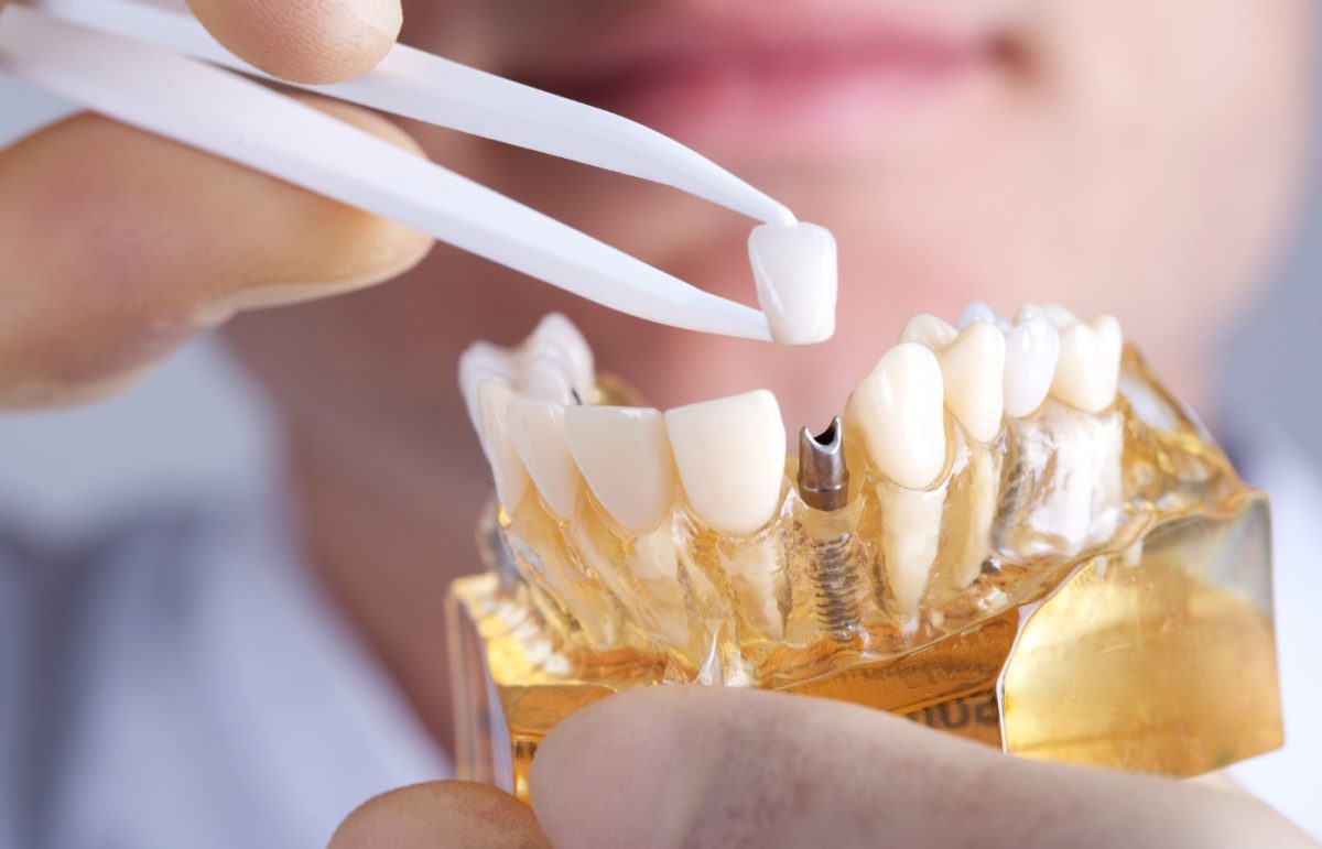 Best Dental Clinic In Mumbai | Complete Family Dental Care