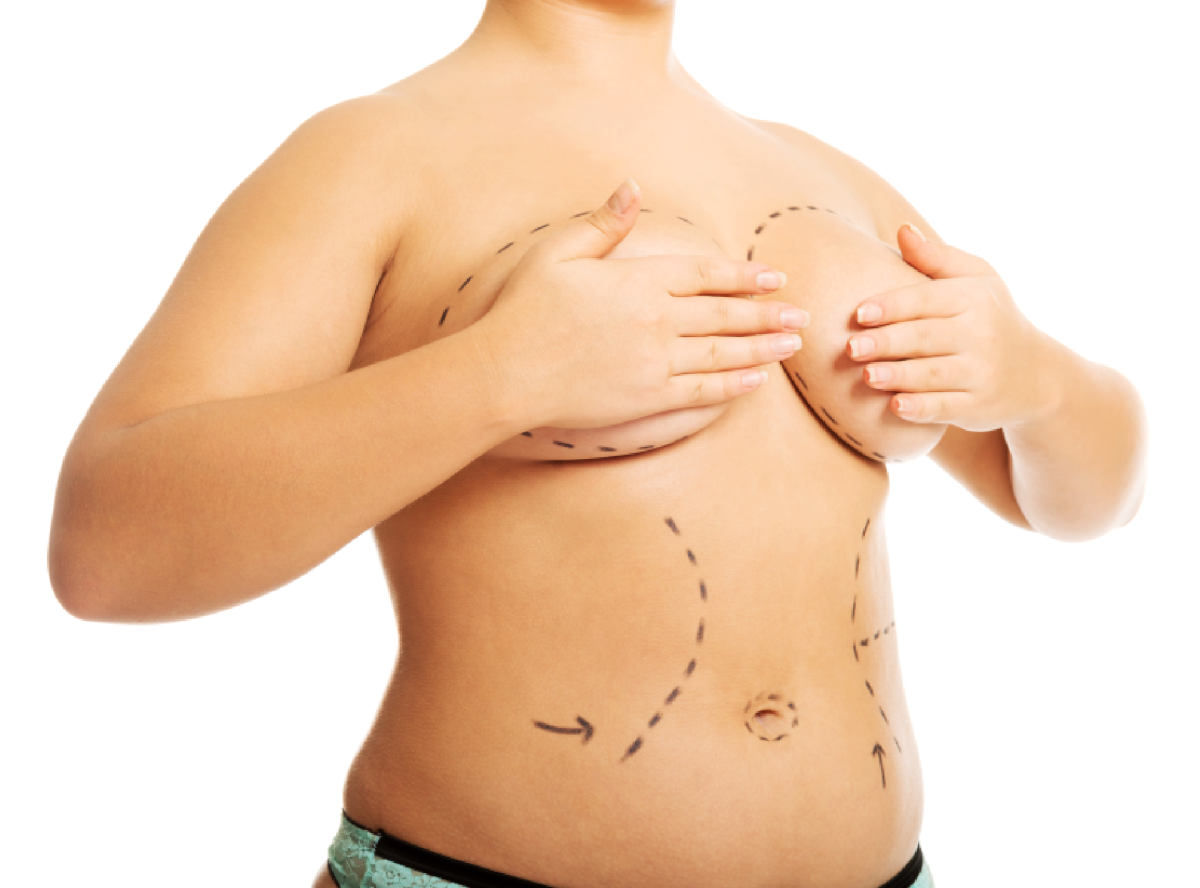 Making Breast Augmentation Recovery More Comfortable