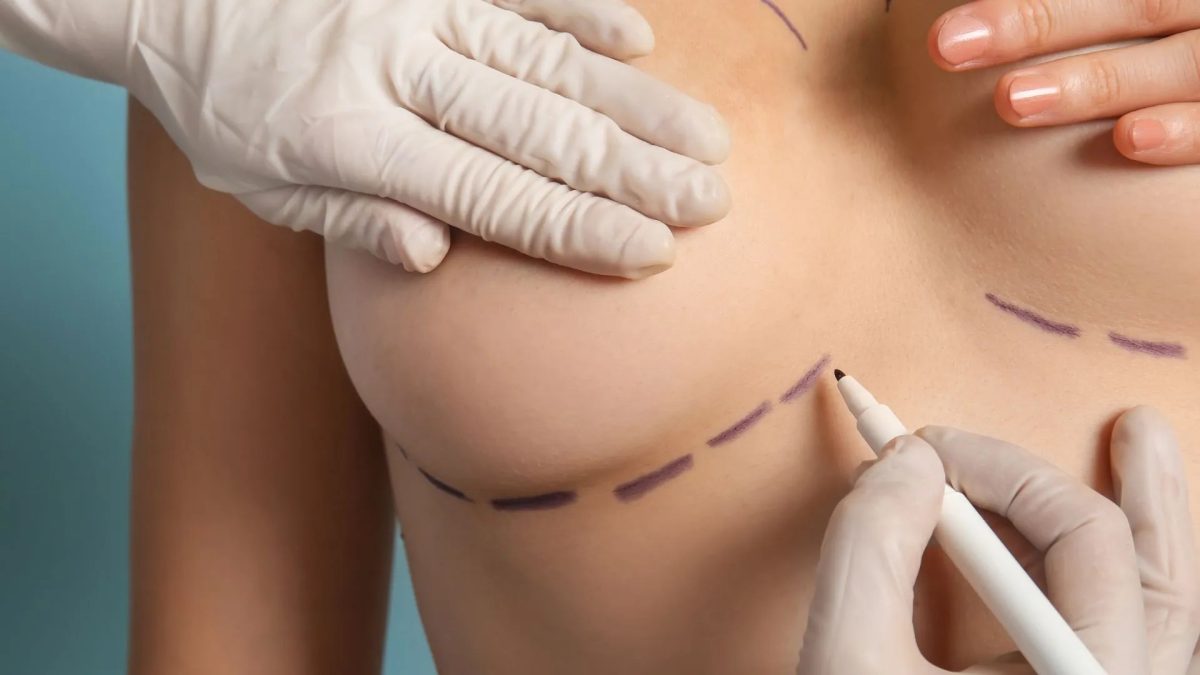 Breast Augmentation in Islamabad: The Proportion Psychology Behind Modern Feminine Aesthetics