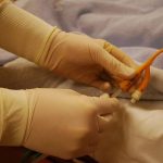 Catheter-care-at-home.jpg