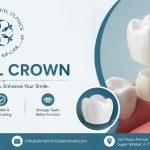 Dental-Crown-in-Islamabad.jpg