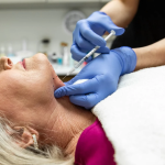 Top-Expert-Tips-for-Choosing-a-Kybella-Clinic.png