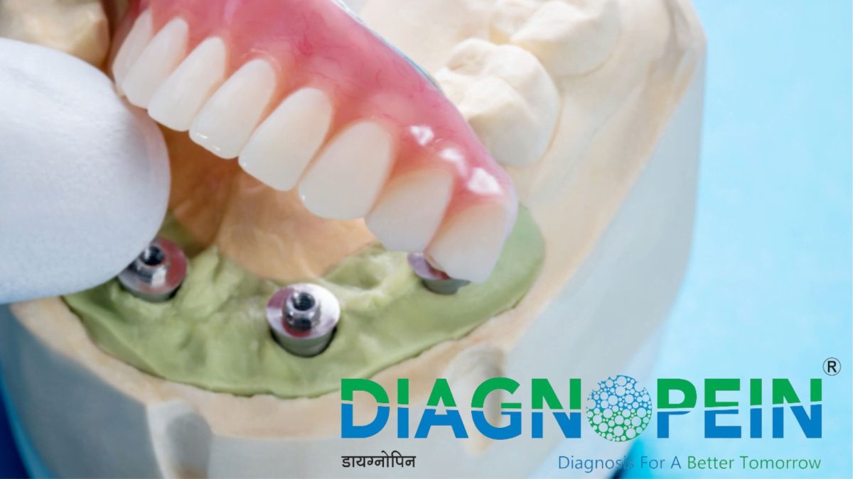 Dental Clinics Mumbai for Quality Treatment and Expert Care