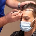 Hair-transplant-in-Islamabad-0.jpg